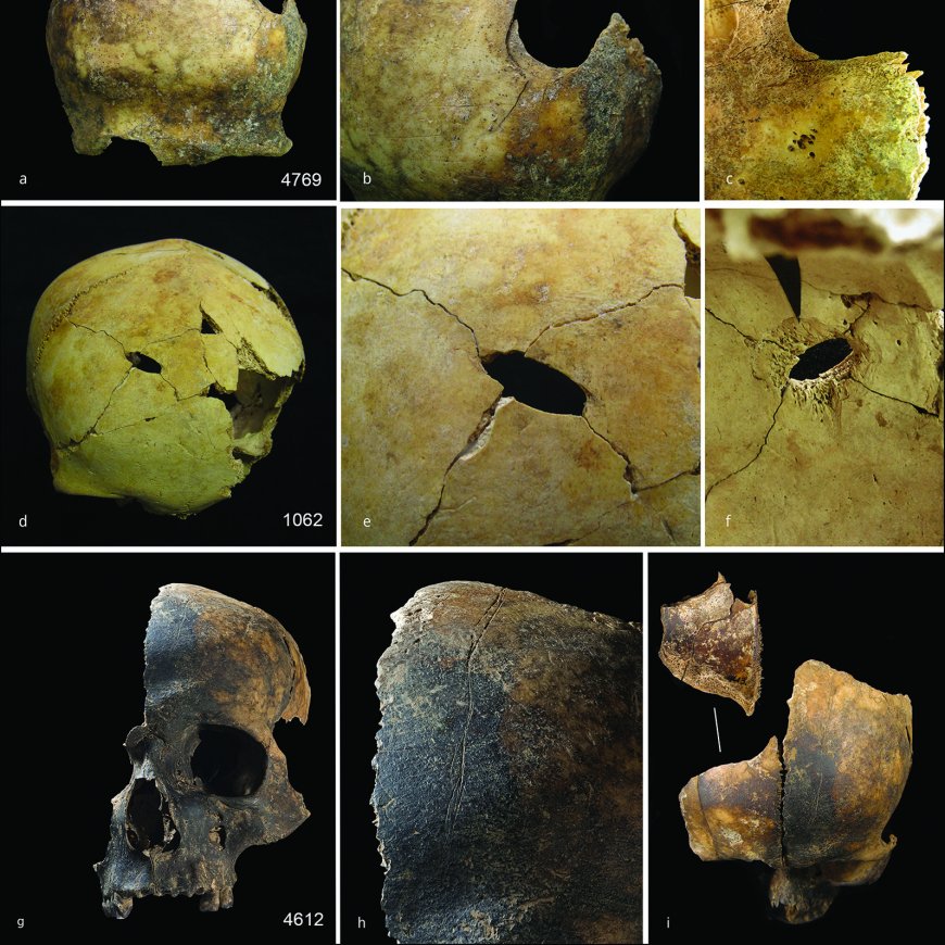 A Grisly Discovery at a Bronze Age Mass Grave: The Victims Were Eaten, Too