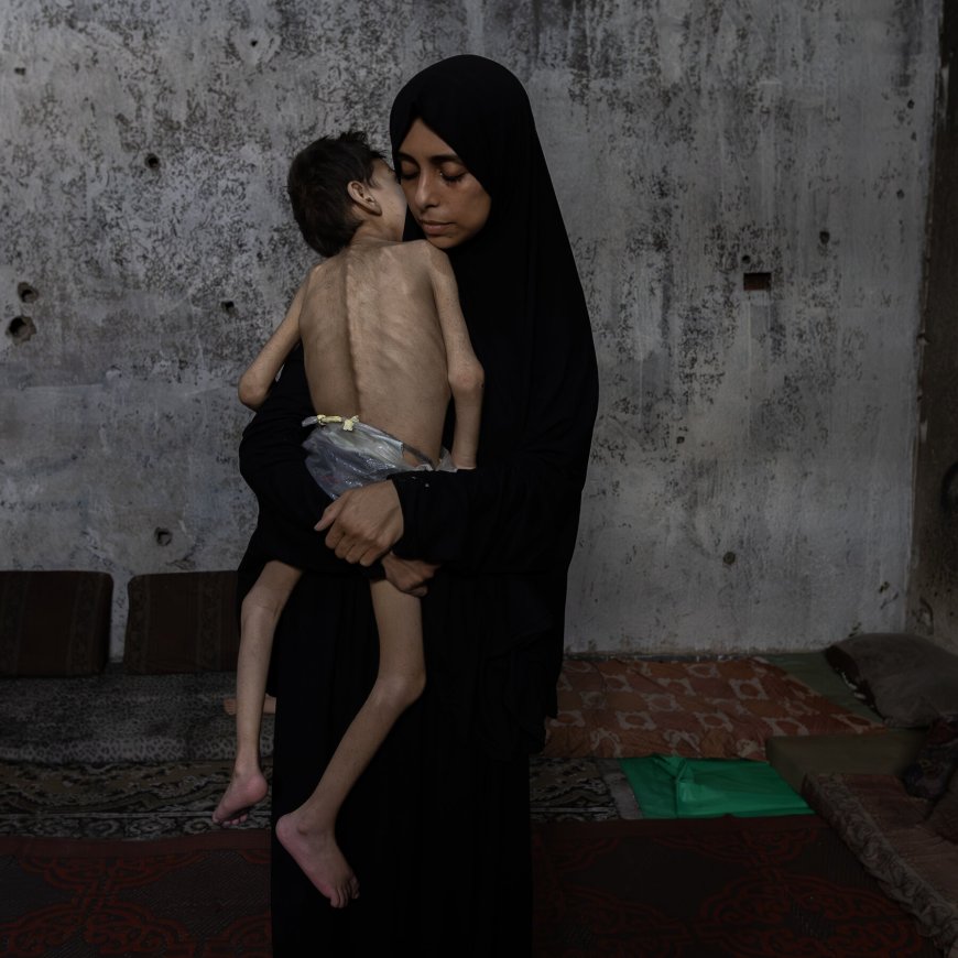 Gazans Are Dying of Starvation